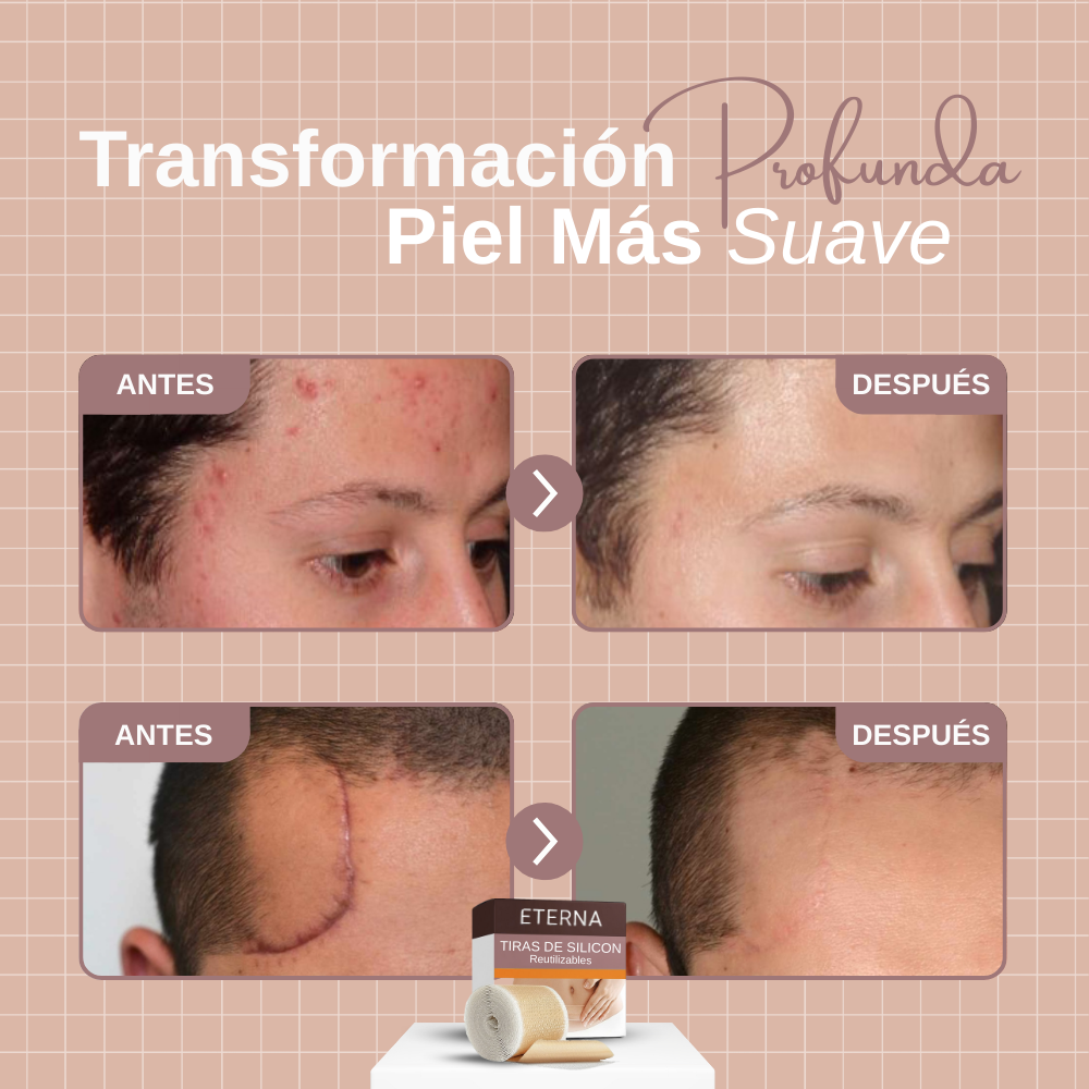 ETERNA PATCHES™ | ALISA ARRUGAS Y SUAVIZA CICATRICES DE FORMA RÁPIDA Y VISIBLE