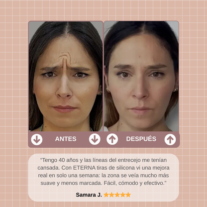 ETERNA PATCHES™ | ALISA ARRUGAS Y SUAVIZA CICATRICES DE FORMA RÁPIDA Y VISIBLE